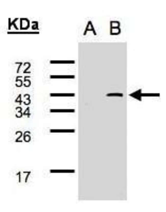 ANTI-GCIP INTERACTING PROTEIN P29