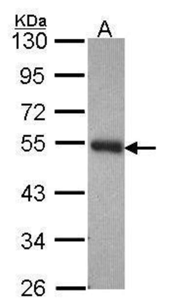Anti-PACSIN3