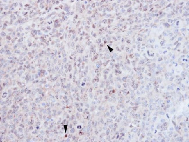 Anti-EZH1
