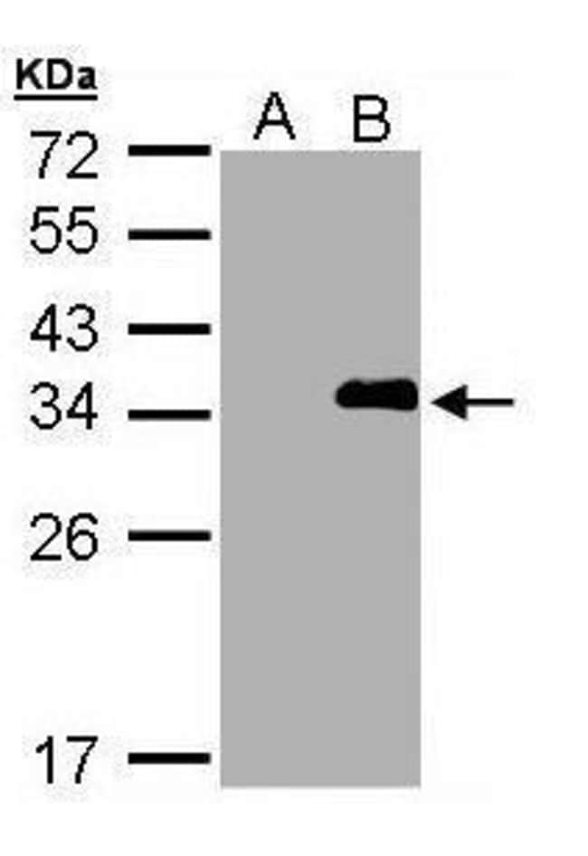 Anti-LASP1