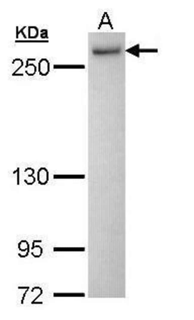 Anti-PRP8
