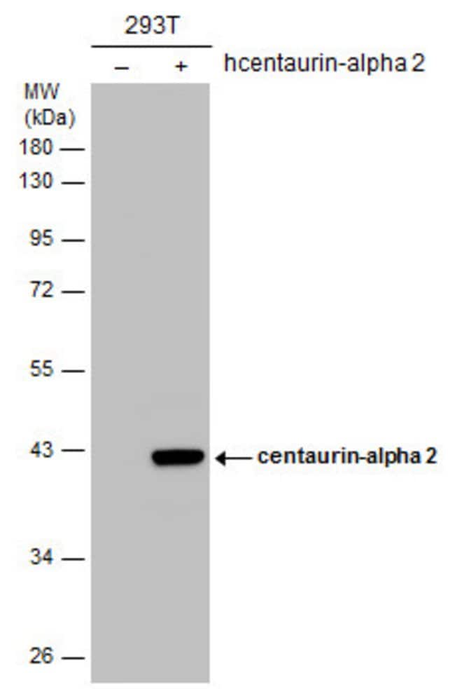Anti-centaurin-alpha 2