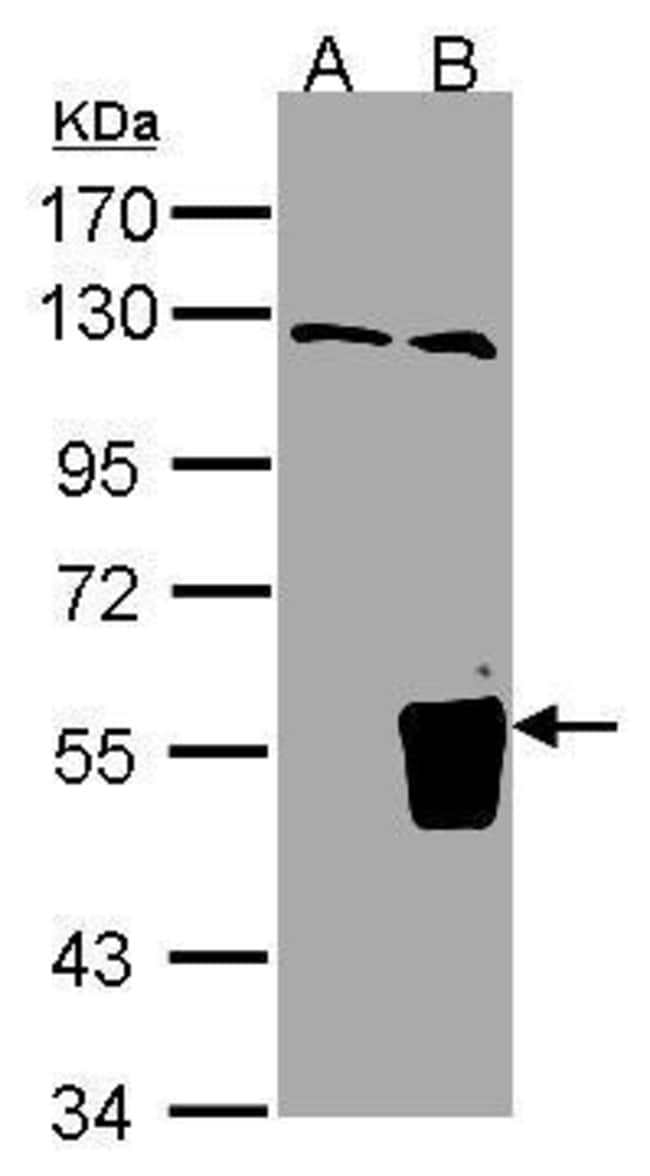 Anti-RNF93