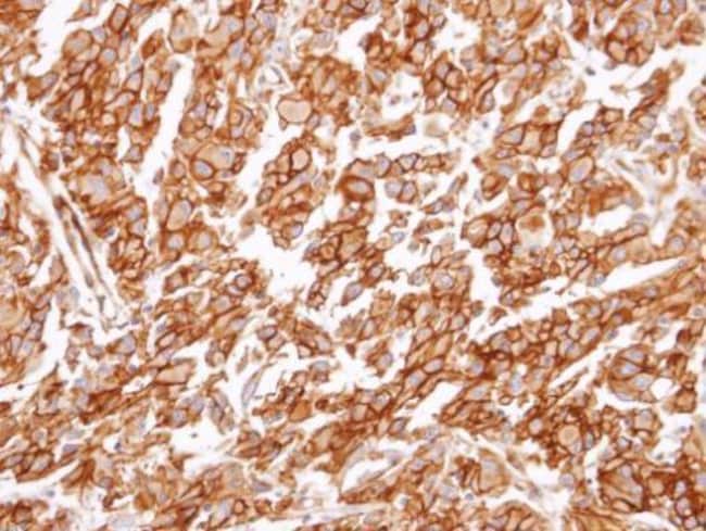Anti-CysLT 1 receptor