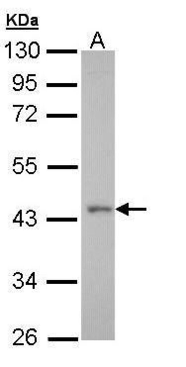 Anti-GPR32