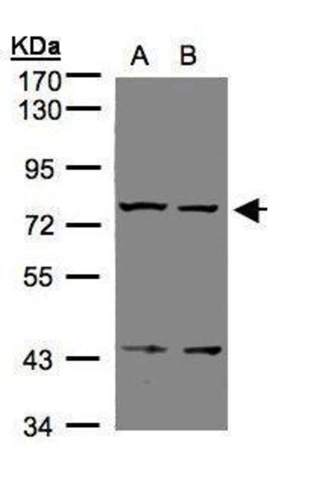 Anti-GPCR LGR7