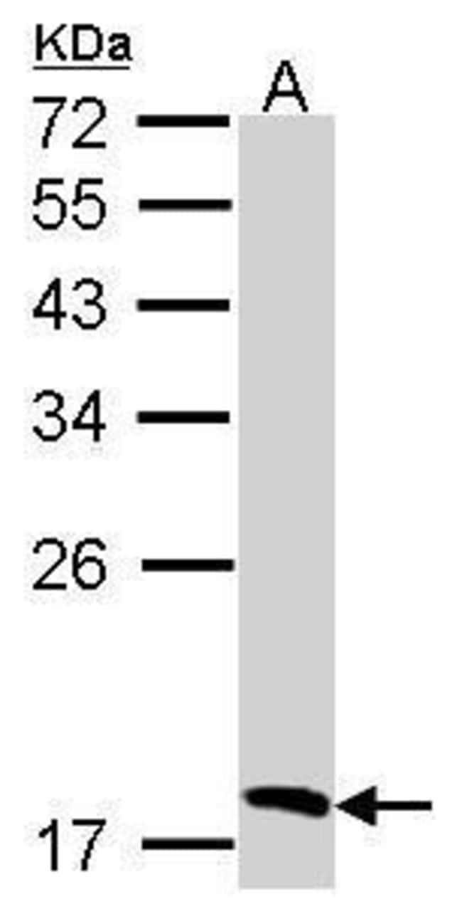 Anti-Flavin reductase