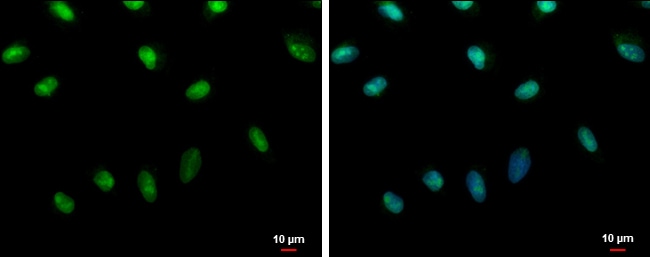 Anti-Histone H2A.x