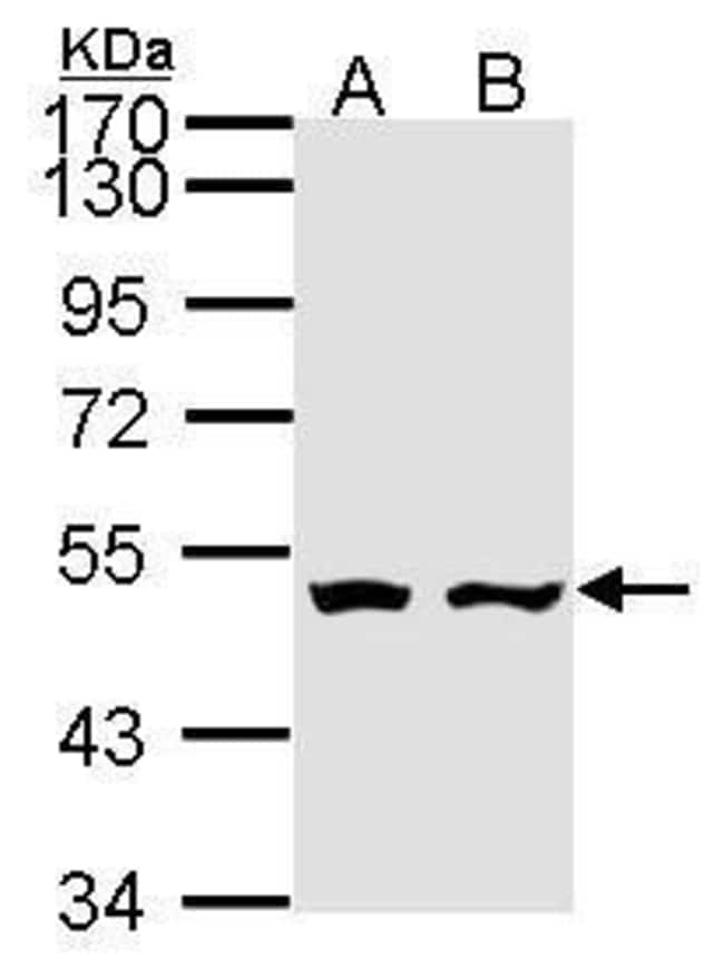 Anti-AKD1