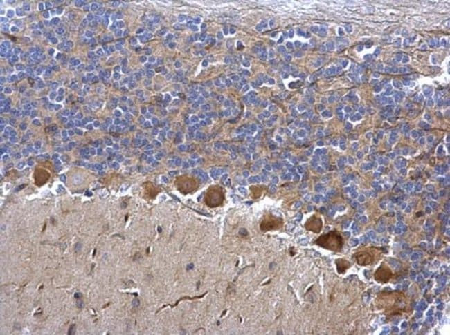 Anti-CDK5