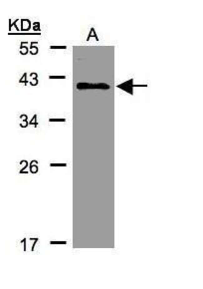 Anti-KLHDC8A