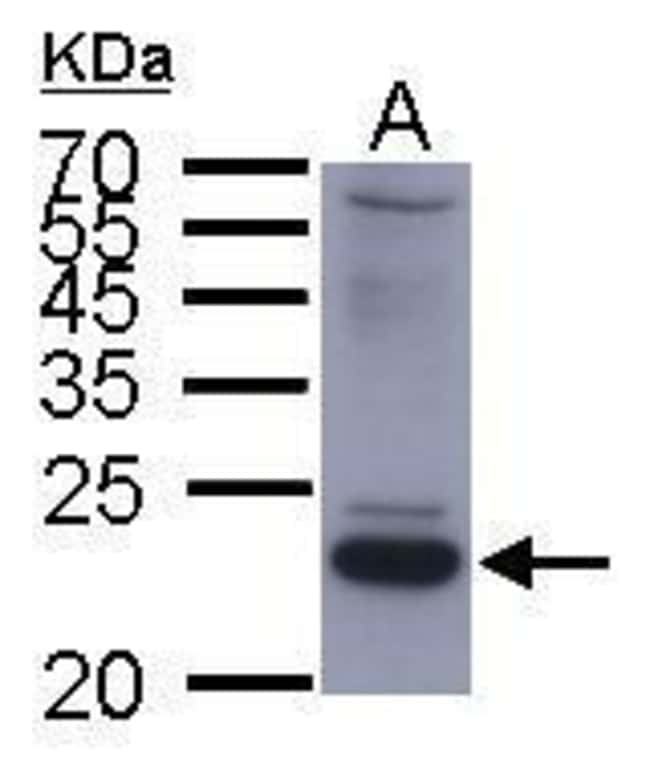 Anti-small S Protein (HBV1a)