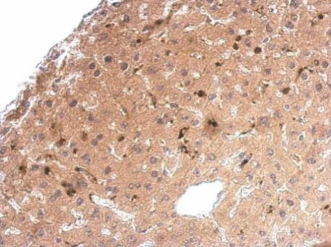 Anti-Syntenin 1