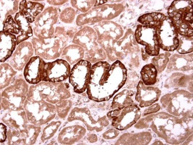 Anti-Inhibin beta B