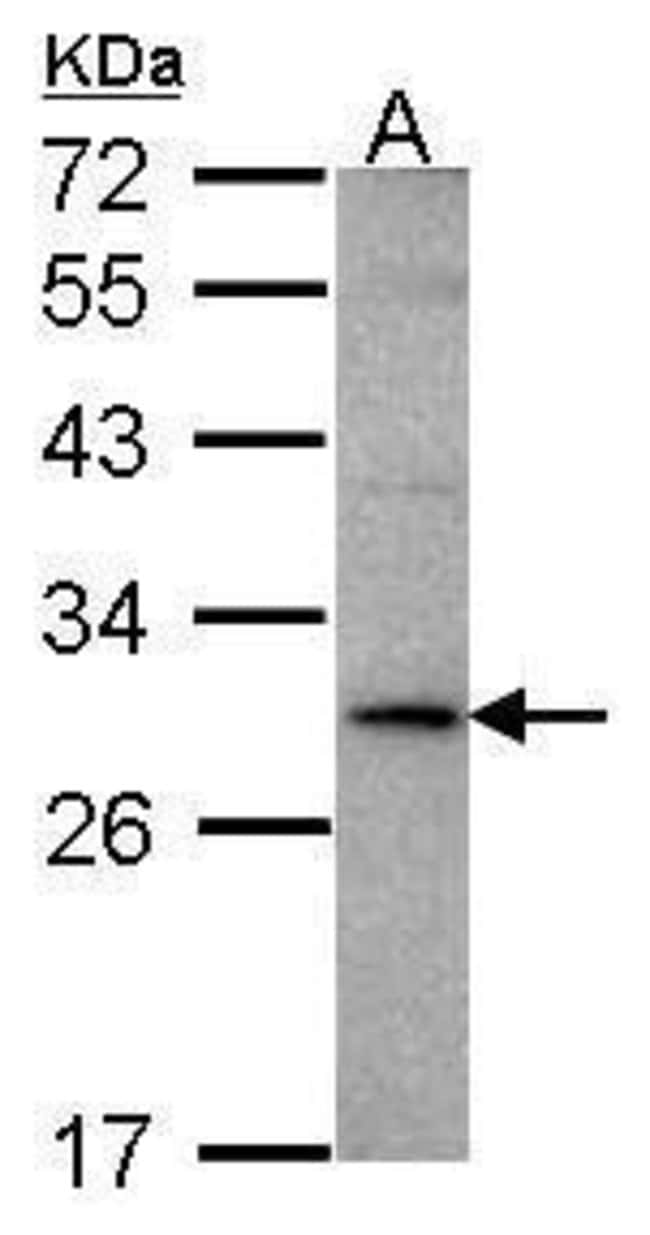 Anti-TL1A