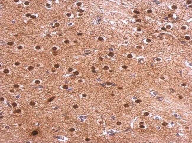 Anti-Syntenin 1