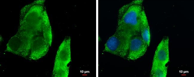 100UL CXCL13 Polyclonal Antibody