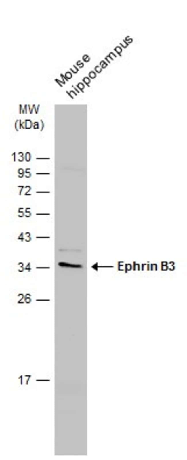 Anti-ephrin-B3