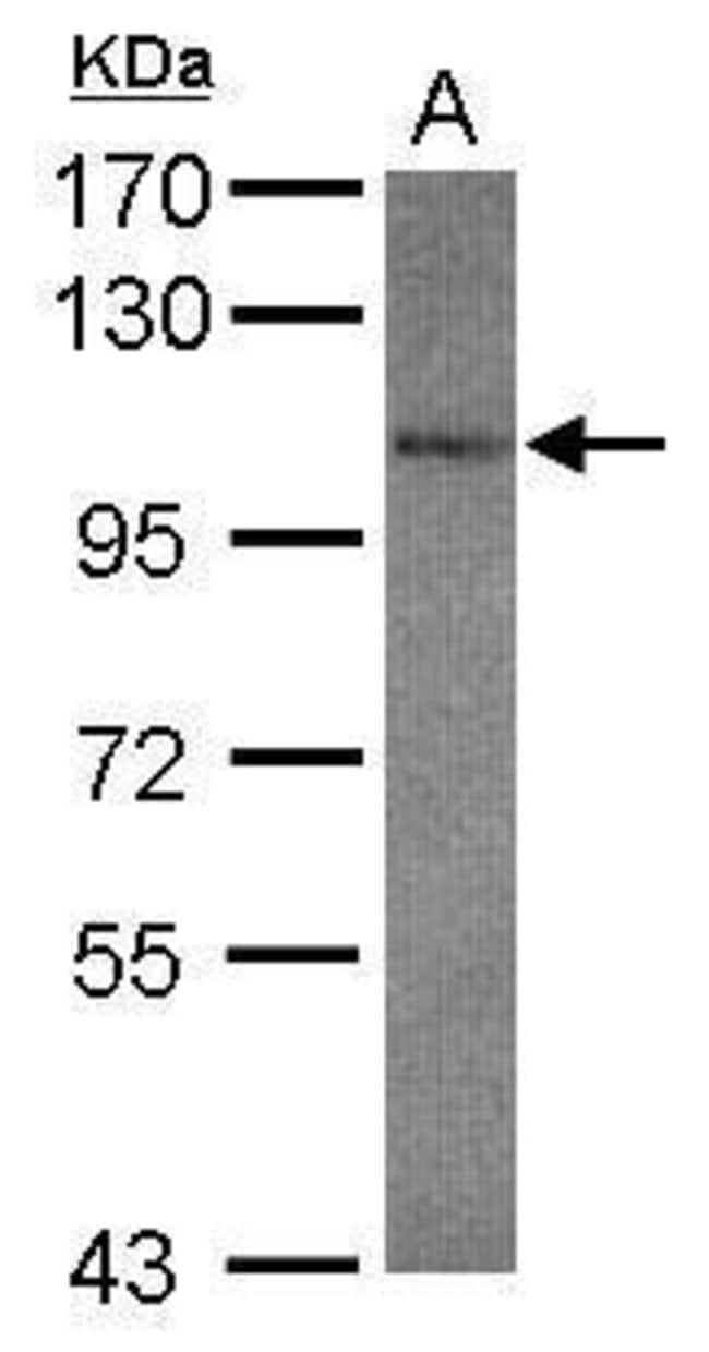 Anti-GluR 7