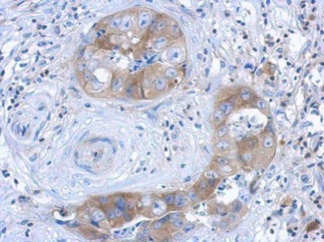 Anti-IL1 Receptor 1