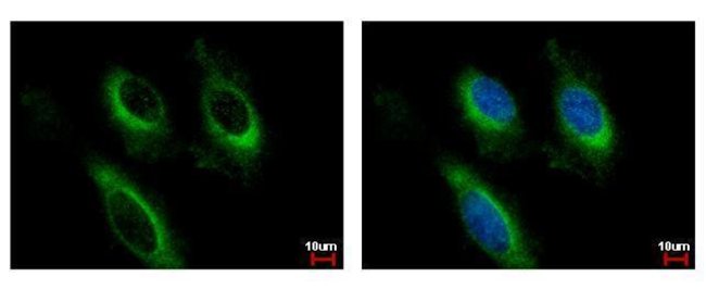 Anti-IL2 Receptor beta