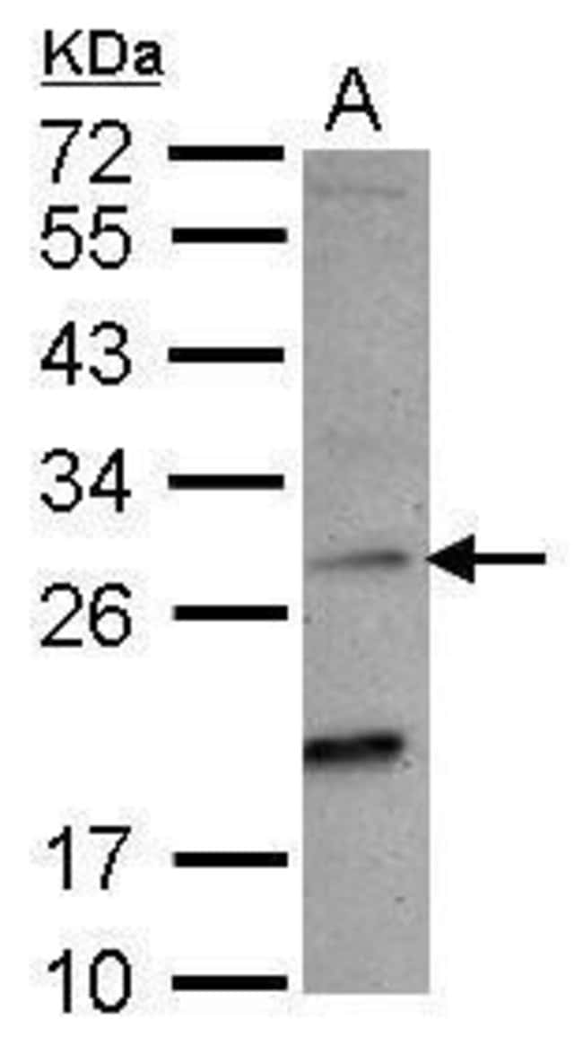 Anti-NKG2-C