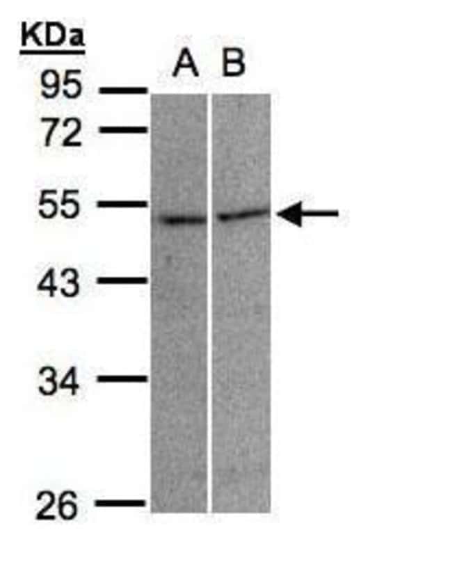 Anti-Glycine Receptor alpha 3