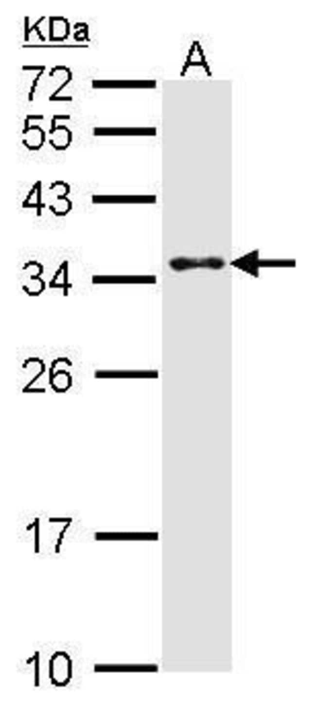 Anti-CRSP9