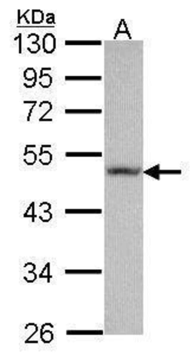 Anti-Fibulin 5