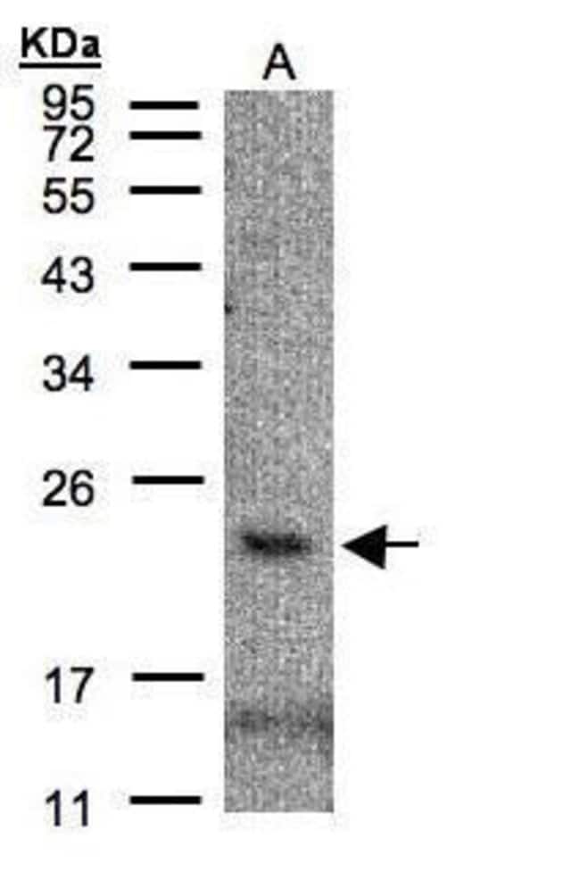 Anti-CMTM3