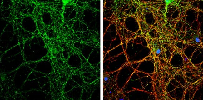 Anti-PACSIN1