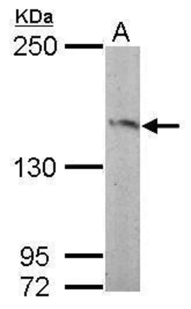 Anti-Ras GRF2