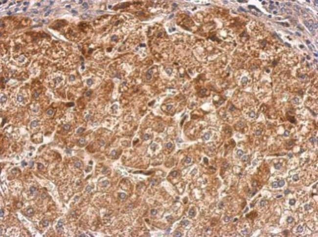 Anti-RASGRP2