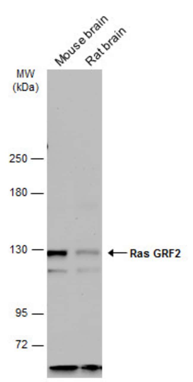 Anti-Ras GRF2