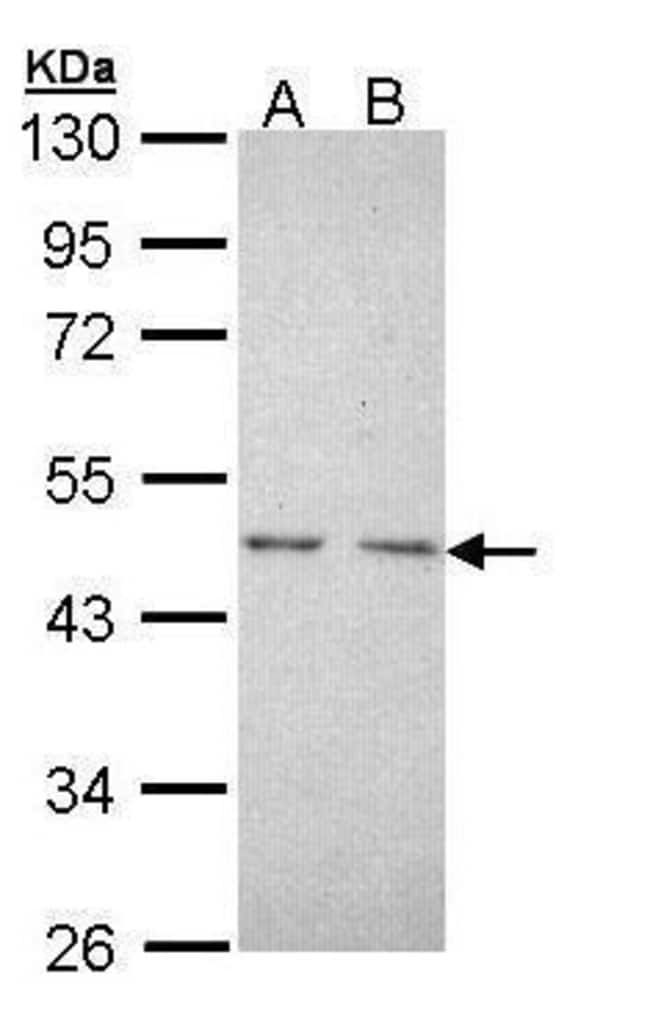 Anti-TR2