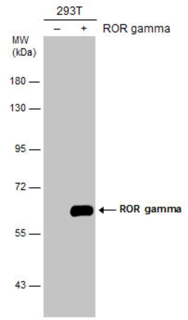 Anti-ROR gamma