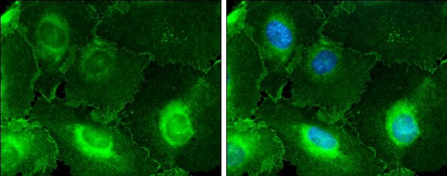 Anti-CD146