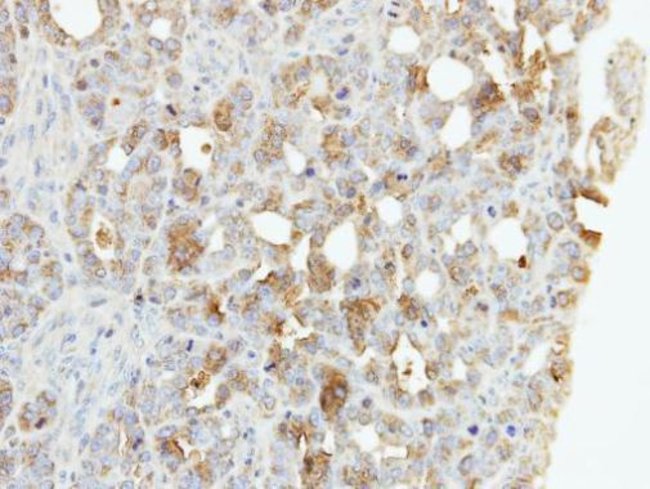 Anti-ZNF223