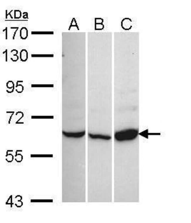 Anti-CACNB1