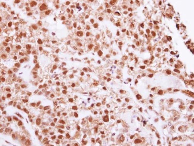 Anti-DNA ligase IV