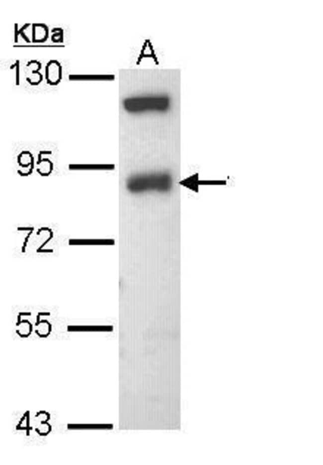 Anti-betaENaC