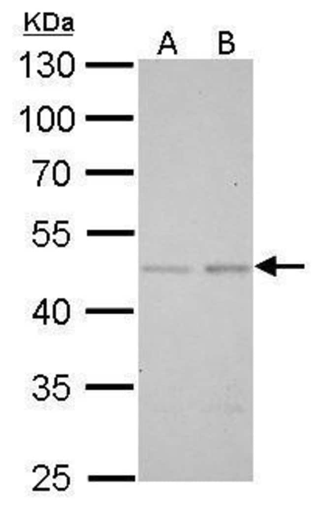 Anti-SMAD5