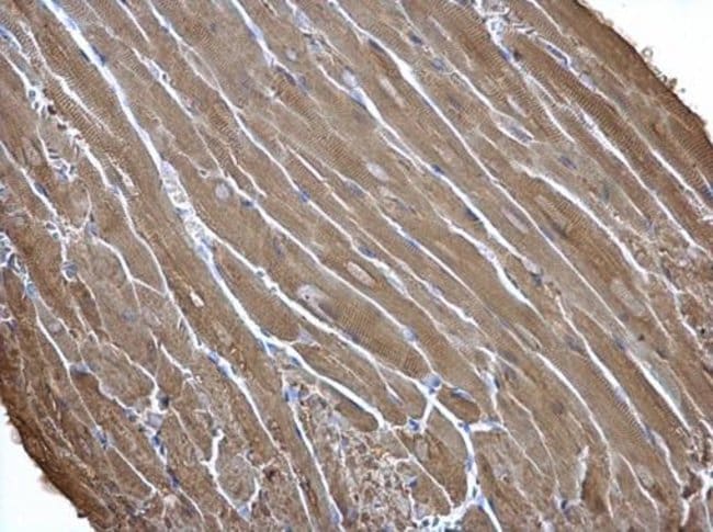 Anti-Creatine kinase (muscle)