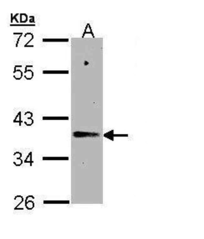 Anti-Napsin A