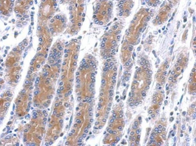 Anti-HSD17B6