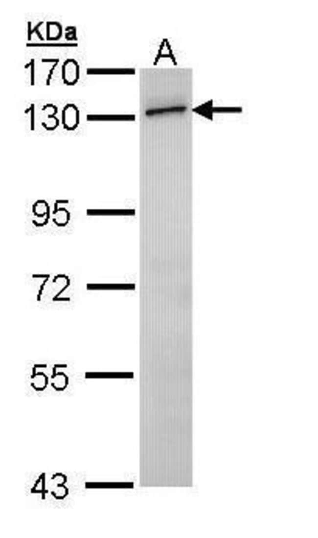 Anti-RNF20