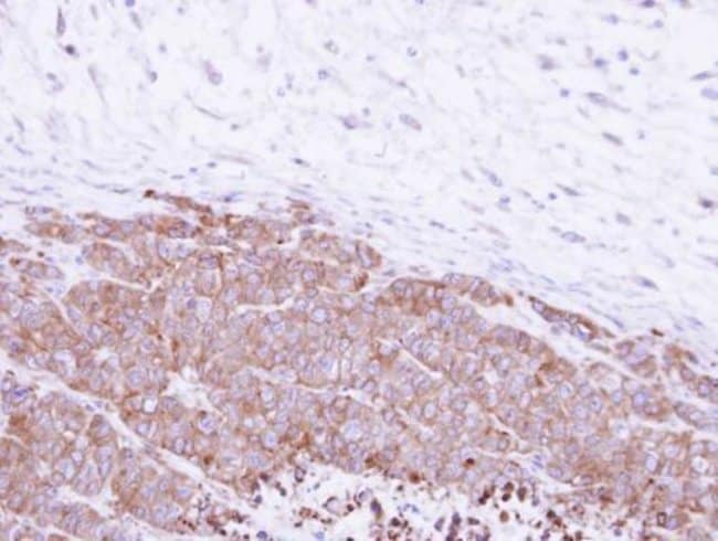Anti-Glutamyl hydrolase gamma