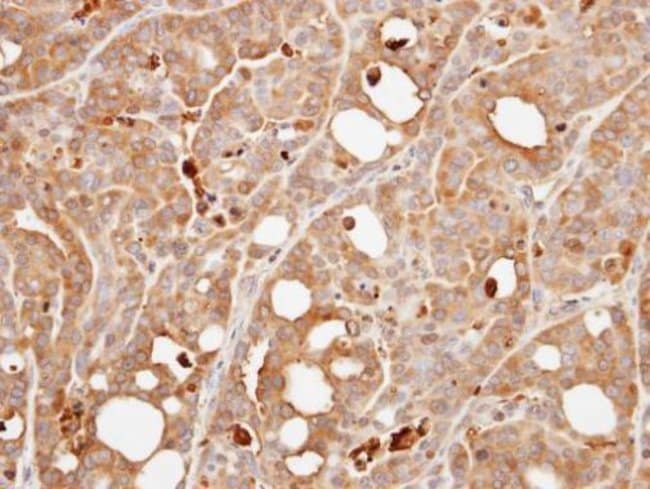 Anti-Calcineurin B