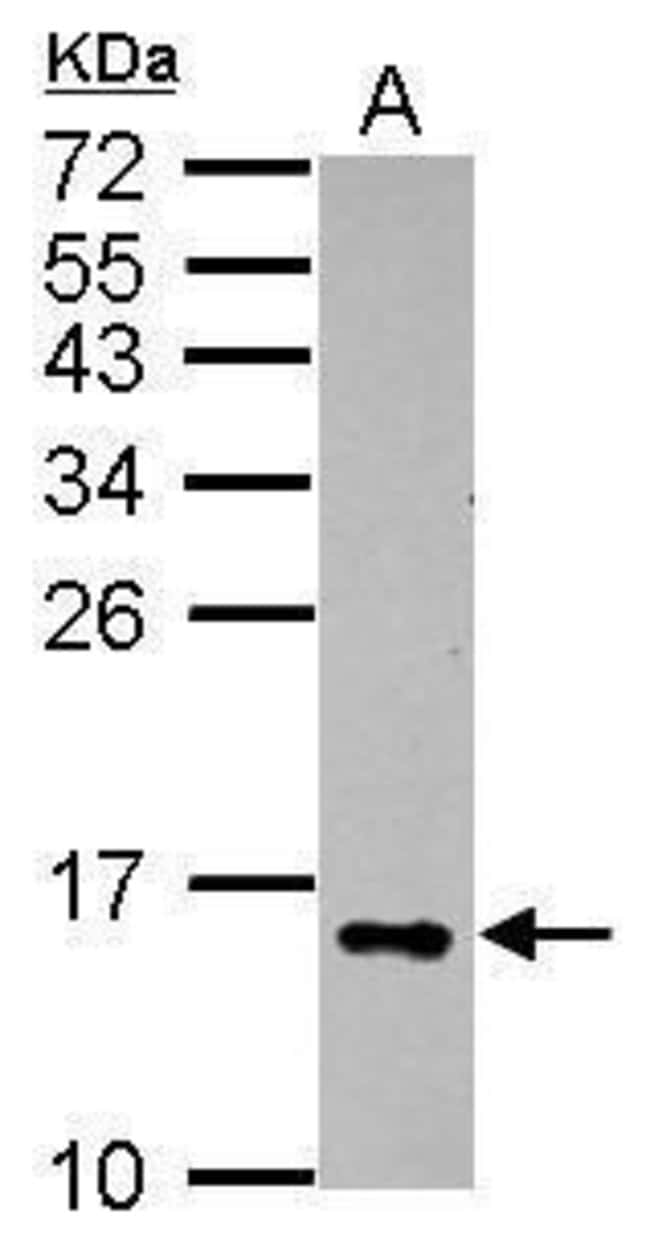 Anti-Galectin 2