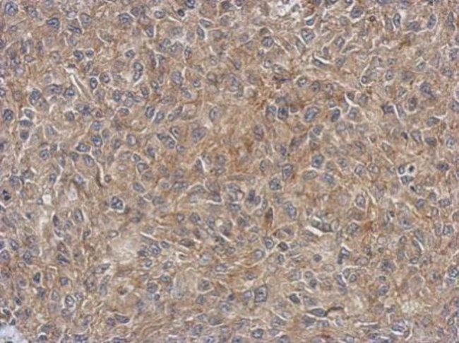 Anti-EIF4EBP1